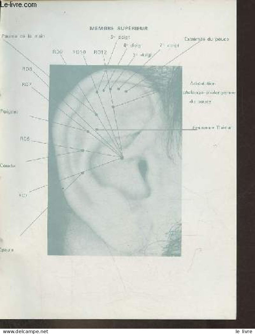 Traité D'auriculothérapie. - Nogier Paul F.M. - 1969 - Gezondheid