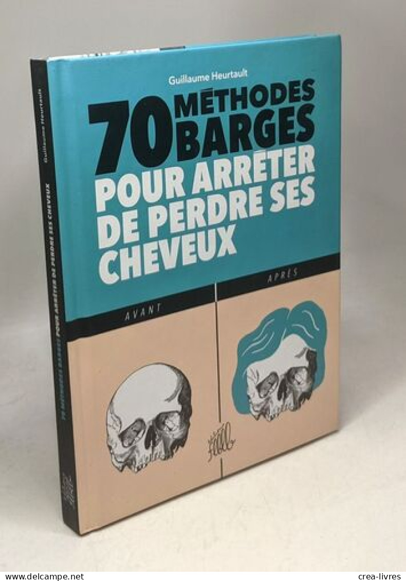 70 Méthodes Barges Pour Arrêter De Perdre Ses Cheveux - Other & Unclassified