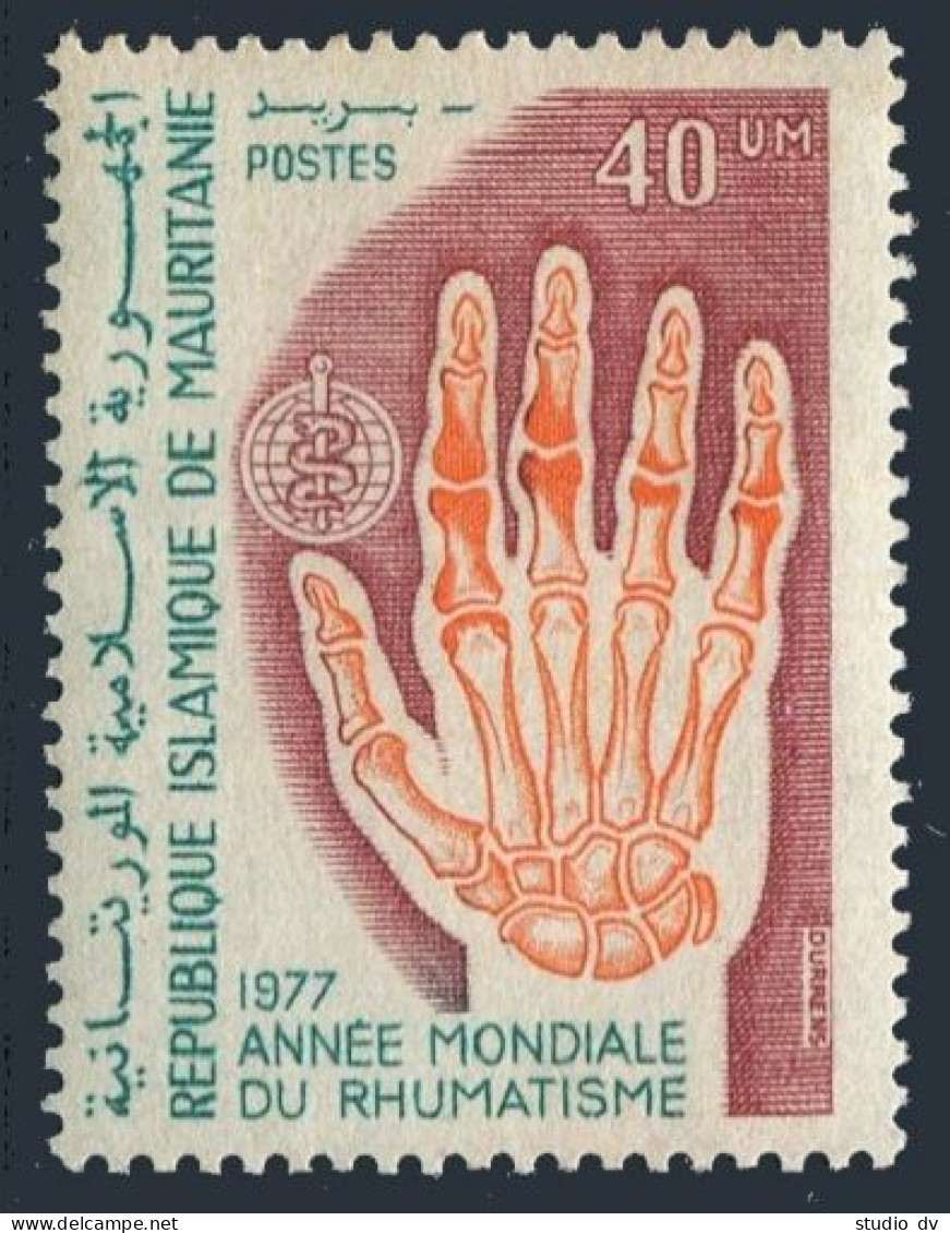 Mauritania 366,MNH.Michel 574. World Rheumatism Year, 1977. X-ray Of Hand. - Mauretanien (1960-...)