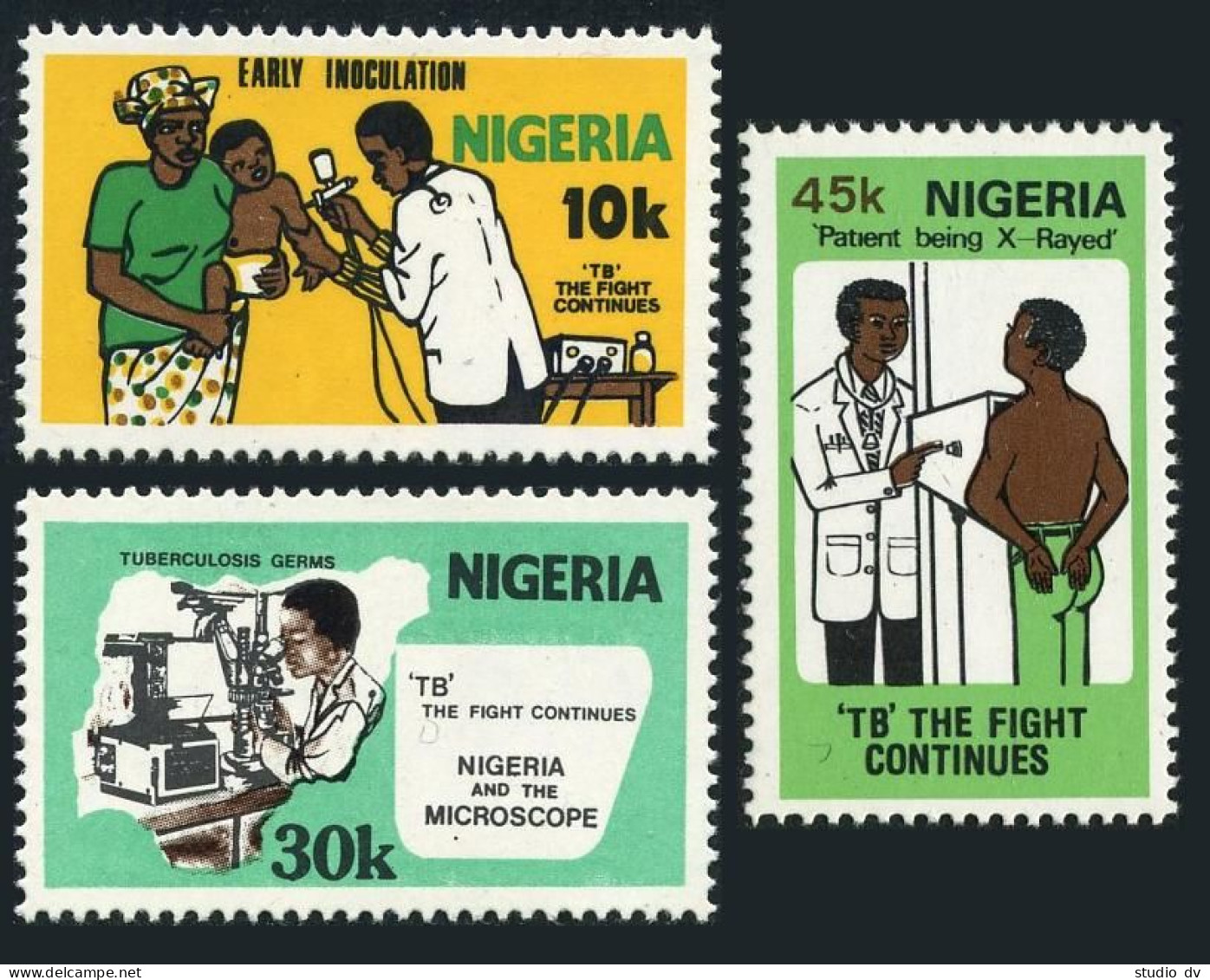 Nigeria 409-411, MNH. Michel 393-395. TB-bacillus Centenary, 1982. - Niger (1960-...)