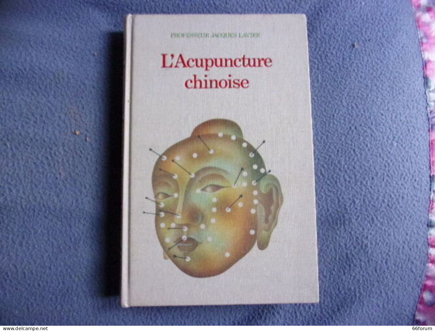 L'acupuncture Chinoise - Gezondheid