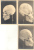 RARA COLECCION DE 7 FOTOGRAFIAS DE CRANEOS SKULLS QUE PERTENECIERA A UN ANTROPOLOGO ARGENTINO CIRCA 1910 RARES - Health
