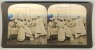 Japan (~1900´s) Amputating The Leg - Operation - Military Reserve Hospital (´Perfec´ Stereograph - H.C. White) - Stereoscoop