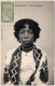 MADAGASCAR - Femme De L'Ambongo  (Recto/Verso) - Madagaskar