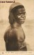 BURKINA-FASO TYPE LOBO ETHNOLOGIE AFRIQUE - Burkina Faso