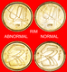 √ ABNORMAL RIM: SPAIN ★ 5 PESETAS 1998! LOW START ★ NO RESERVE! Juan Carlos I (1975-2014) - 5 Pesetas