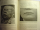 TRAITE DE PATHOLOGIE ET DE THERAPEUTIQUE - SYPHILIS TOME 2 - A. MALOINE & FILS 1921 - FERNET FOURNIER SERGENT - Medecine - 1901-1940