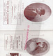 Delcampe - 87- LIMOGES -PROGRAMME THEATRE MUNICIPAL1923-MOUSQUETAIRES AU COUVENT-LOUIS VARNEY-DELPRET-ROSE MANCEAU-HELENE DUVERNAY- - Programmes