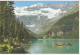 AK 181639 CANADA - Alberta - Lake Louise And Victoria Glacier - Lac Louise