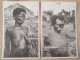 Oubangui-Chari Lèpre Leprosy 2 Cpa Collection Ethnographique Vergiat - Non Classificati