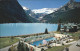 12020847 Lake Louise Chateau Lake Louise Swimming Pool Canadian Rockies  - Unclassified