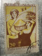 VIET NAM Stamps(1982-AGRICULTURE-WORKER-30 XU) PRINT ERROR(ASKEW)1 STAMPS-vyre Rare - Vietnam