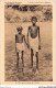 AICP2-ASIE-0124 - LES CAPUCINS FRANCAIS AUX INDES - Deux Pétites Victimes De La Famine - India