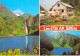 31 - Bagnères De Luchon - Lac D'Oô - Multivues - Autres & Non Classés