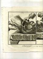 - CHIRURGIE . PL.14 ET 2e PL.14 . EAU FORTE   DU XVIIIe. S. . - Medisch En Tandheelkundig Materiaal