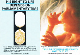 His Right To Life Depends On Parliamentary Time - Baby Of 18 Weeks Gestation - This Is The Picture Pro-abortionists Hate - Non Classés