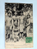Carte Postale Ancienne : LAOS : Ethnographie , L'Opération Du Limage Des Dents Chez Les KHAS-KASENG , Timbre - Laos