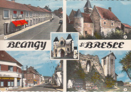 76 - BLANGY SUR BRESLE / MULTIVUES - Blangy-sur-Bresle