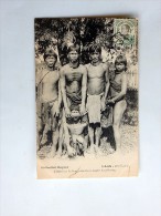 Carte Postale Ancienne : LAOS : L' Operation De Limage Des Dents Chez Les KHAS-KASENG - Laos