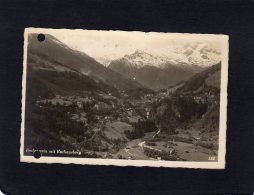 54179   Austria,  Badgastein Mit Rathausberg,  VG - Bad Gastein