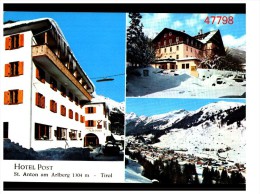 St Anton Hotel - St. Anton Am Arlberg