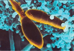 Carte Des Laboratoires Jansen: Trichophyton Mentagrophytes Champignon  Champignons Mushroom Seas Pilzzet - Pilze