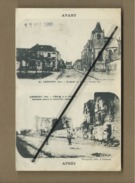 CPA  -  Avant -  Lassigny Bombardée En 1914-15 Grande Rue - Après - Lassigny - L'église Et La Château Bombardée ...etc.. - Lassigny