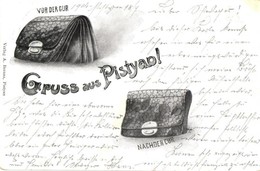 T2 Pöstyén, Piestany; A Kezelés Előtt és Után, Pénztárcák, Humor / Before And After The Cure. Humorous Postcard - Zonder Classificatie