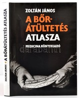 Zoltán János: A B?rátültetés Atlasza. Bp., 1984, Medicina. Vászonkötésben, Papír Véd?borítóval, Jó állapotban. - Ohne Zuordnung