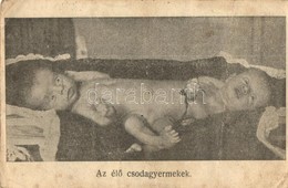 T3/T4 Az él? Csodagyermekek. Magyar Sziámi Ikrek A Rákóczi út 57/b Luther Házban / Conjoined Twins, Circus Attraction (f - Non Classificati