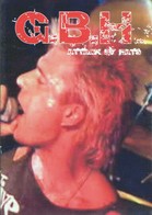 GBH - Attack By Rats - DVD - PUNK - DVD Musicali