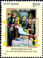 HEALTH-150 YEARS OF ANAESTHESIA- PAIR- ERROR-YELLOW SHIFTED- INDIA-1996- SCARCE- MNH- H-620 - Errors, Freaks & Oddities (EFO)