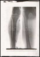 Cca 1930 Orvosi Röntgenfelvételek, 8 Db Vintage Negatív Fekete György (1904-1990) Budapesti Fényképész Hagyatékából, 3x3 - Sonstige & Ohne Zuordnung