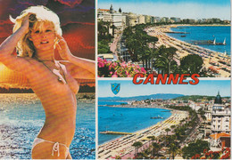 ALPES MARITIMES : Cannes : La Croisette, Côte D'azur, Femme Dénudée (nu, Sein) - Cannes