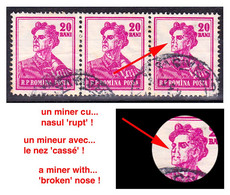 ROMANIA / ROUMANIE : 1955 ( Yv. 1385 ) - ERREUR / PRINTING ERROR : MINEUR Au NEZ CASSÉ / MINER With BROKEN NOSE ! (ag477 - Abarten Und Kuriositäten