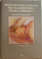 Prostatectomia Radicale Per Via Retropubica: Tecnica Chirurgica Di Aa.vv.,  1993 - Geneeskunde, Biologie, Chemie