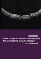 Atlas Of Optical Coherence Tomography For Approaching Macular Diseases OCT Made Simple - Medecine, Psychology