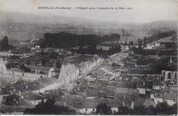 JOINVILLE - L'HOPITAL APRES L'INCENDIE DU 13 MARS 1916 - Joinville Le Pont