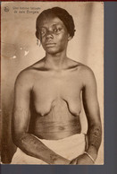 Une Femme Tatouée De Race Bangala ( Seins Nus ) - Africa