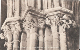 Toothache & Thorn In Foot, Wells Cathedral - Wells