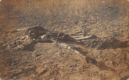 SOUDAN  - Carte-Photo -  Cadavre Mort De Soif Et Dévoré Par Les Chacal Dans Le Désert  - Squelette - Post-Mortem - Sudan