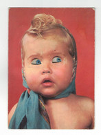 Carte Postale Semi-Moderne à Système Yeux 赤ちゃん Oeil 眼睛 Presbytie 目 Presbyte 婴儿 Baby 老眼 Bébé 老花眼 TB.Etat - A Systèmes