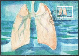 Greenland 2008.  Tuberculosis Control.  Michel 511 Maxi Card. - Cartas Máxima