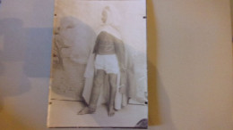 RARE  TUNIS TUNISIE 1913 Photographie Originale  Eléphantiasis SUR HOMME MILITAIRE UNIFORME  HOPITAL SADIKI - Salute