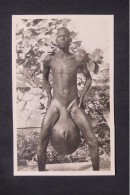 CAMEROUN - Carte Postale Photo D'un Homme Atteint D'éléphantiasis - Très Rare - A 483 - Cameroun