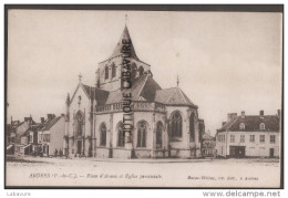 62---ARDRES--Place D'Armes Et Eglise Paroissiale----animé - Ardres