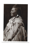 Amerindien, Machpish, Apsaroke Warrior, Mountain Crow - Indian, Shot In The Hand - Photo 1908 Azusa Postcard - Native Americans