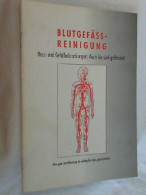 Blutgefässreinigung Herz- Und Gefäßerkrankungen: Auch Sie Sind Gefärdet! - Salud & Medicina