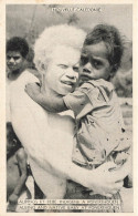 FRANCE - Nouvelle Calédonie - Albinos Et Bébé Indigène à Ponerihouen - Carte Postale Ancienne - Nouvelle Calédonie