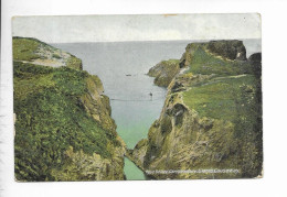 ROPE BRIDGE. CARRICK A REDE. GIANTS CAUSEWAY. - Other & Unclassified